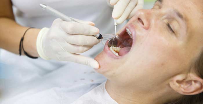 How to Prevent Gum Disease and Keep Your Teeth Healthy in Manhattan Beach, CA area