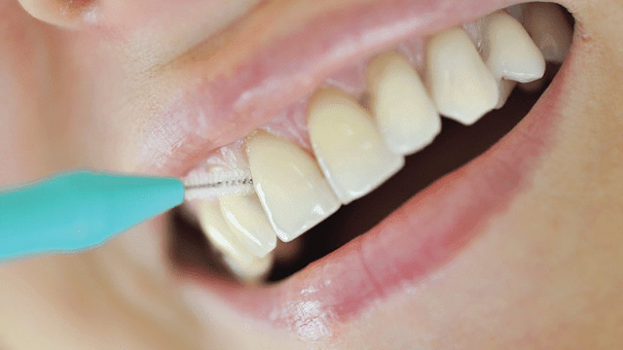 How often should I get professional teeth cleaning - West Hollywood  Holistic and Cosmetic Dental Care