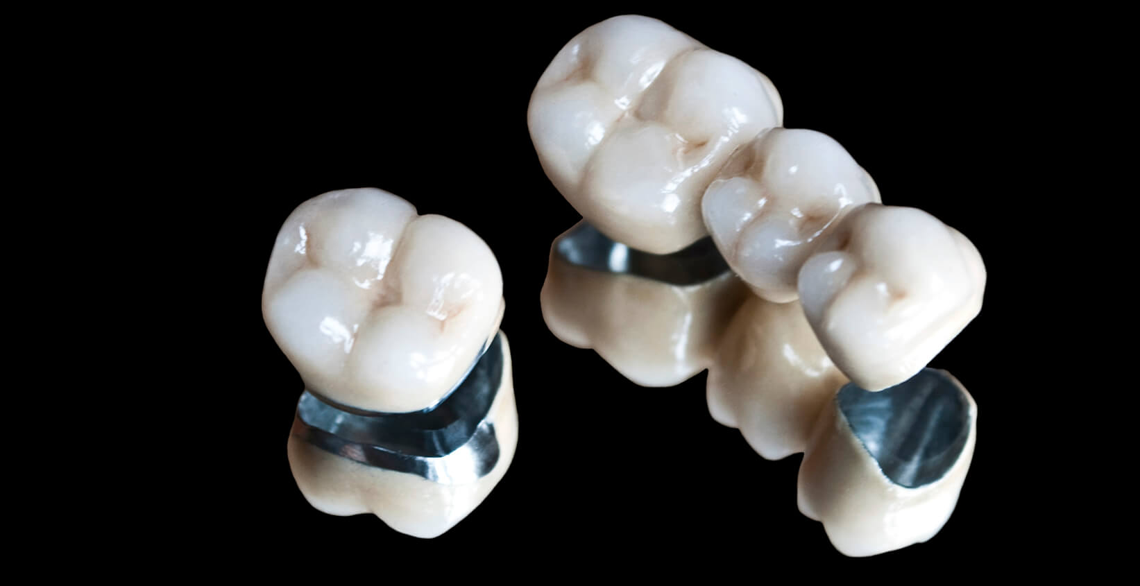 Restore the appearance and resilience of your teeth with Same-day Crowns